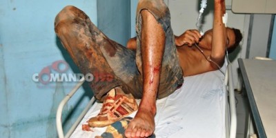 OURO PRETO - Um assaltante é baleado durante troca de tiros com a PM; Suspeito mora em Ji-Paraná