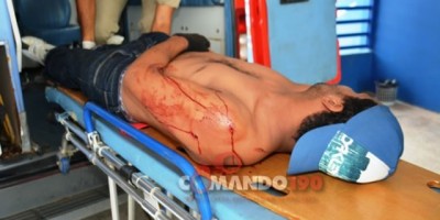 Ji-Paraná – Mototaxista leva três facadas durante roubo, em Ji-Paraná; Assaltante leva moto CM 183