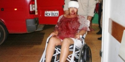 Vilhena - HOMEM TENTA MATAR ESPOSA; ELA LEVOU FACADA NA CABEÇA