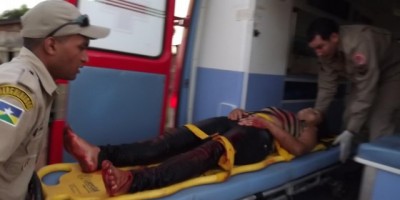 Rolim de Moura – Mulher é esfaqueada pelo próprio marido e foi socorrida em estado grave para o Hospital
