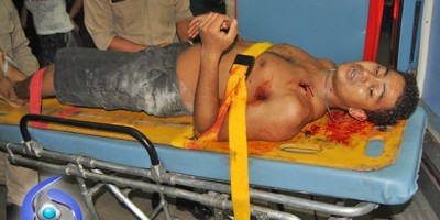 Ji-Paraná – Homem é alvejado com seis tiros e morre ao dar entrada no HM