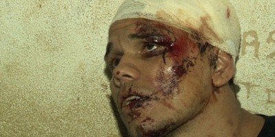 PORTO VELHO -Assaltante morre e outro se fere gravemente após roubo em residência de Coronel da PM