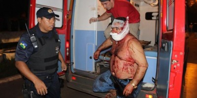 Cacoal – Rolim de Moura: Acerto de contas termina com um ferido a golpes de facão e outro alvejado a tiros (Seguem mais fotos)