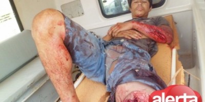 Cacaulândia - Grave acidente deixa um morto e um ferido na zona rural 