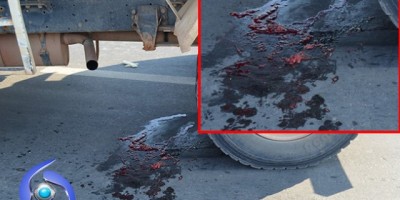 Ji-Paraná – Mulher tem a perna dilacerada em acidente envolvendo moto e caçamba