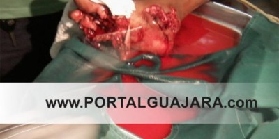 Guajará-Mirim -  Policiais Bolivianos (Leopardos) atiram em Adolescente do lado Brasileiro 