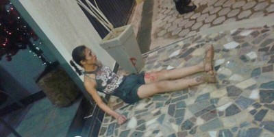 Ji-Paraná – Travesti é baleado após discussão com suposto cliente   