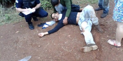 RO-010 -  Motociclista fratura perna em acidente de trânsito