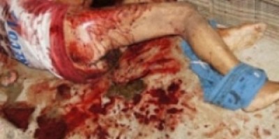 Bahia - Mulher arranca o pênis do marido com pedaço de ferro