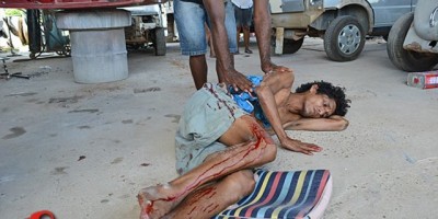 Ji-Paraná – Briga entre moradores de rua termina em um esfaqueado e o outro na Delegacia de Polícia