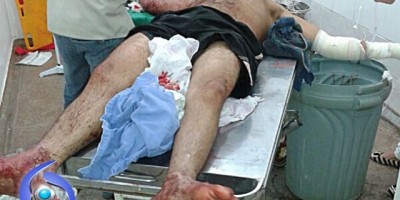 Cacoal - Homem tenta invadir residência e fica gravemente ferido ao ser cortar em vidro da janela