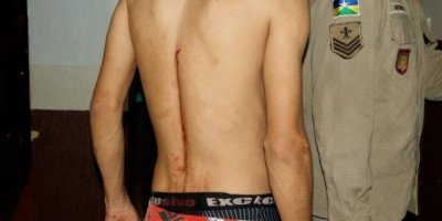 Rolim de Moura –  Jovem tenta separar briga e acaba esfaqueado