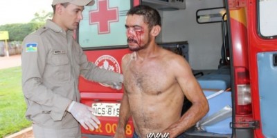 Rolim de Moura – Durante briga em boca de fumo homem é atingido por golpe de foice  