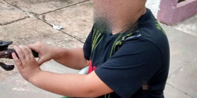 Rolim de Moura – Campanha para arrecadar fundos para tratamento do menino atacado por cães da raça Pitbull