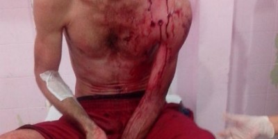Seringueiras - Homem é baleado pela vítima ao arrombar e adentrar em residência