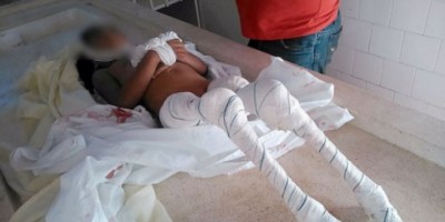 Monte Alegre-PA – Criança de apenas 06 anos morre devorada por piranhas – IMAGENS FORTES