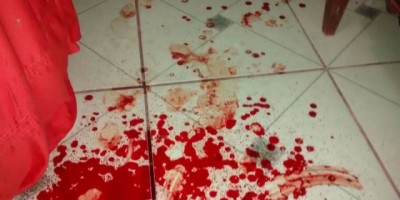Rolim de Moura –  Homem sofre tentativa de homicídio em residência próximo ao Parque de Exposições