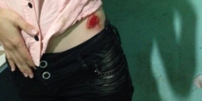 Jaru - Jovem é arrastada por assaltantes durante roubo em via pública