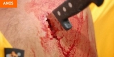 Ariquemes - Jovem da entrada em hospital de Ariquemes com faca cravada nas costas