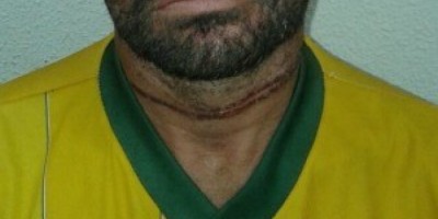 Ceará - Homem é torturado e enterrado vivo no Ceará e sai de cova sozinho