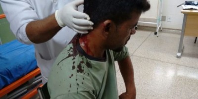 São Francisco do Guaporé - Homem é alvejado com tiro na cabeça no terminal rodoviário