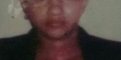 Itapuã do Oeste - Mulher é brutalmente executada a tiros na presença do marido.