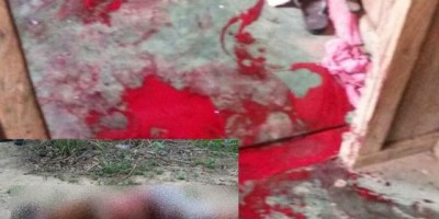 Nova Brasilândia – Homem é morto a facadas por uma mulher durante briga; a mulher foi socorrida em estado grave ao Hospital