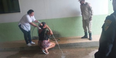 Ouro Preto do Oeste - Cadeirante joga soda cáustica na ex-mulher e nos dois filhos