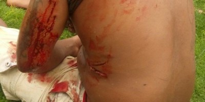 Rolim de Moura -  Indivíduo tenta furtar residência na linha 176, mas acaba surpreendido e baleado pelo dono da propriedade - Vídeo