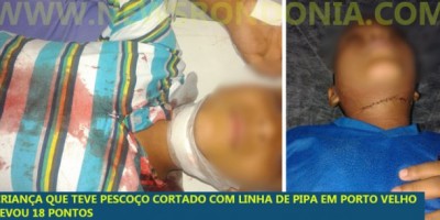 CEROL - Mistura perigosa usada em diversão, causa acidentes em Porto Velho