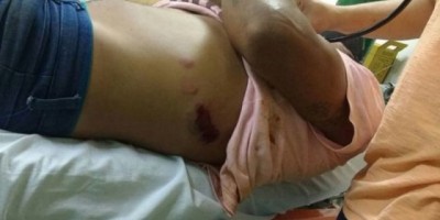 São Francisco do Guaporé - Briga generalizada em carnaval, deixa um ferido ao tentar agredir policial.