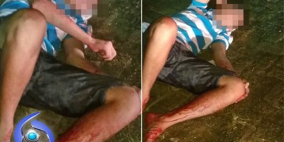 Adolescente é baleado na perna ao tentar assaltar policial militar em Porto Velho