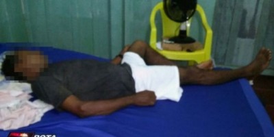 São Francisco do Guaporé - Dupla espanca idoso e rouba dinheiro