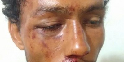 Rolim de Moura – Suspeito tenta furtar comércio e acaba levando uma surra do proprietário