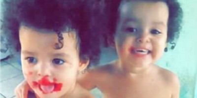 Gêmea de 2 anos atropelada por trator tem perna amputada, em Ariquemes