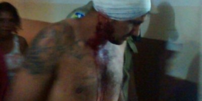 Rolim de Moura - Em tentativa de homicídio, homem leva facãozada na cabeça 