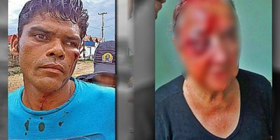 Ji-Paraná – Por causa de R$ 2,00, homem espanca idosa de 78 anos