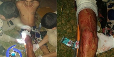 Ji-Paraná – Apenado do regime semiaberto sofre tentativa de homicídio