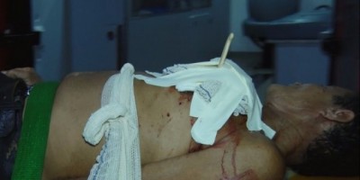 Ji-Paraná -  Homem é socorrido com “faca de serra” cravada no peito