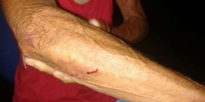 Filho é preso após agredir mãe de 74 anos em São Francisco do Guaporé