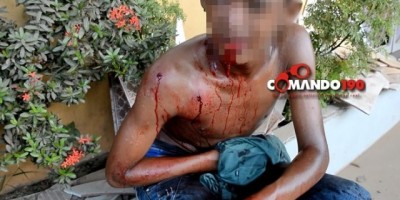 Adolescente com várias passagens pela justiça é alvejado a tiros, em Ji-Paraná