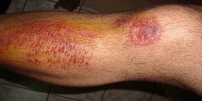 JARU – Adolescente é atropelado enquanto jogava Pokémon GO