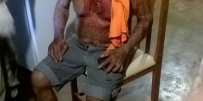 Idoso de 77 anos é espancado dentro de sua residência por casal de assaltantes menores de idade em Jaru 