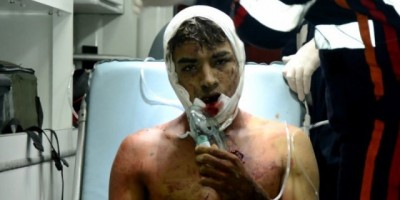 Assaltante atira contra a polícia e é atingido com tiro de fuzil na boca em Rio Branco - AC