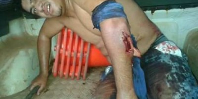 Bandido é baleado após trocar tiros com a polícia em Mirante da Serra