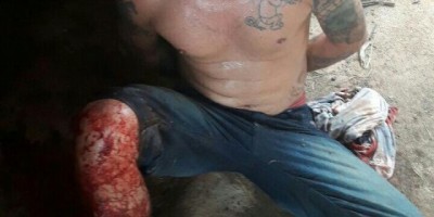 Foragido da justiça é baleado ao tentar tomar arma de PM em Porto Velho