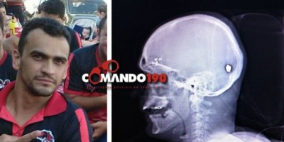 Jovem é baleado na cabeça ao chegar em sua residência, em Ji-Paraná