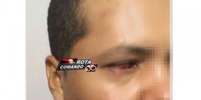 Policiais Militares são agredidos durante ocorrência de briga de familiares em São Domingo do Guaporé