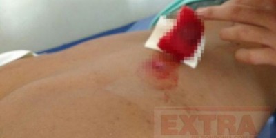 Segurança é atingido por três tiros durante festa em balneário em Vilhena