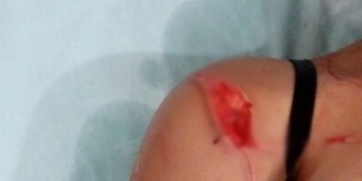 Alto Alegre - Durante briga, adolescente fere três mulheres com canivete em festa no parque de exposições 